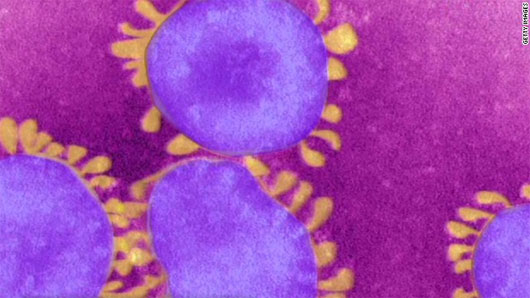 Picture 1 of Detection of SARS-like virus in Spain