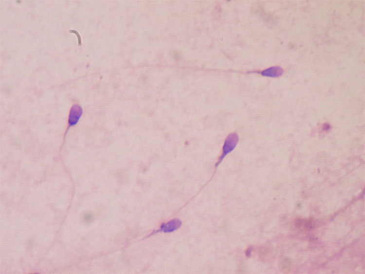 Picture 1 of Detection of sperm structure may contribute to infertility