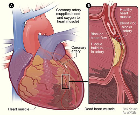 Picture 1 of Detects genes that control the signal of the heart rate