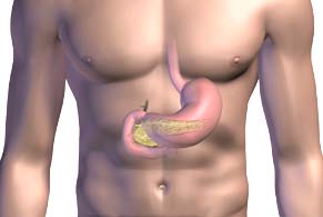 Picture 1 of Determining the marker gene of pancreatic cancer can predict survival