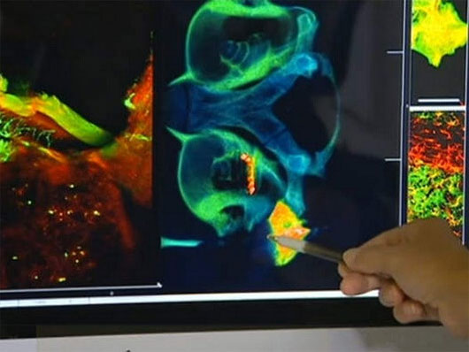 Picture 1 of Develop brain imaging technology for cochlear implant patients