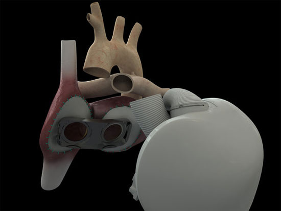 Picture 1 of Development of artificial heart from cow heart tissue