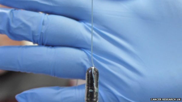 Picture 1 of Diagnosis of esophageal cancer: Sponge capsule instead of endoscopy