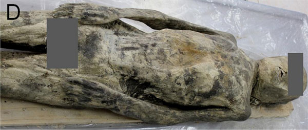 Picture 1 of Diagnosis of mummies