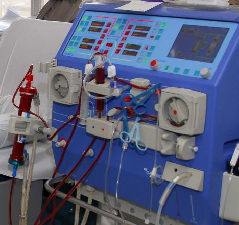 Picture 1 of Dialysis is faster and safer with the new method