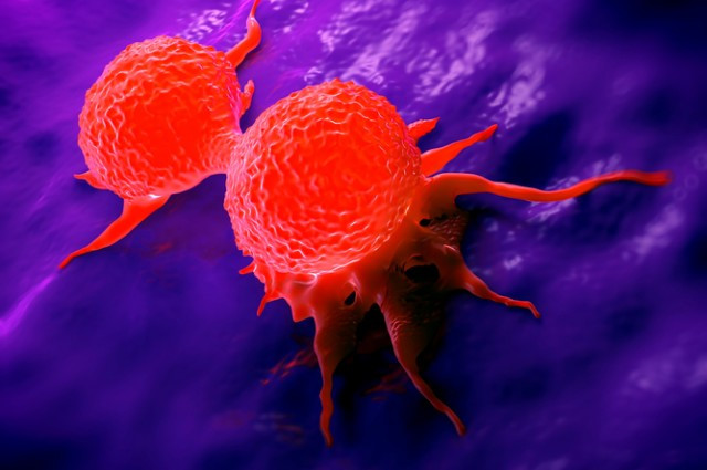 Picture 1 of Diary secret codes of 200 cancer diseases thanks to mathematics in the UK