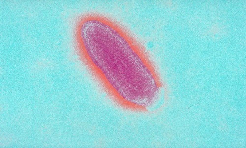 Picture 1 of Differences between viruses, bacteria and parasites