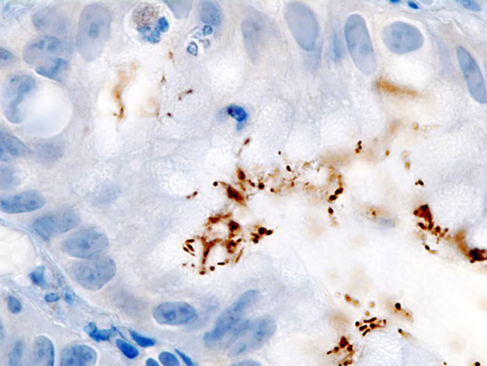 Picture 2 of Differences between viruses, bacteria and parasites