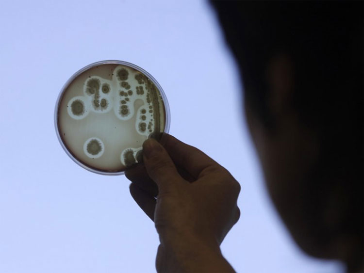 Picture 1 of Disaster when bacteria disappear from Earth