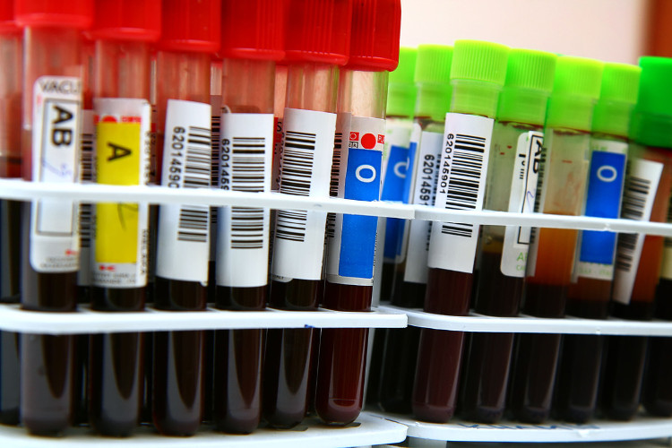 Picture 1 of Discover 2 new blood groups