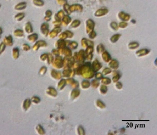 Picture 1 of Discover algae fraud