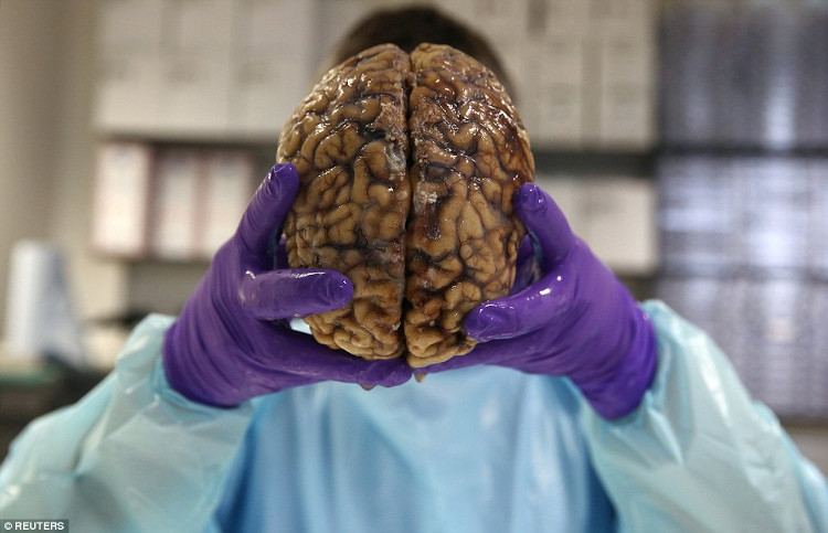 Picture 1 of Discover Britain's largest brain bank