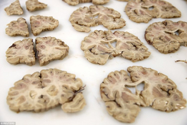 Picture 2 of Discover Britain's largest brain bank
