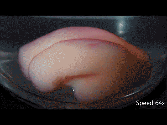 Picture 1 of Discover how wrinkles form through 3D printed brain