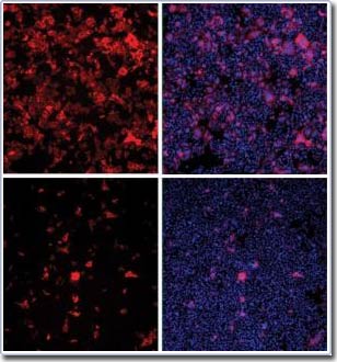 Picture 1 of Discover hundreds of proteins of people who are taking advantage of HIV virus