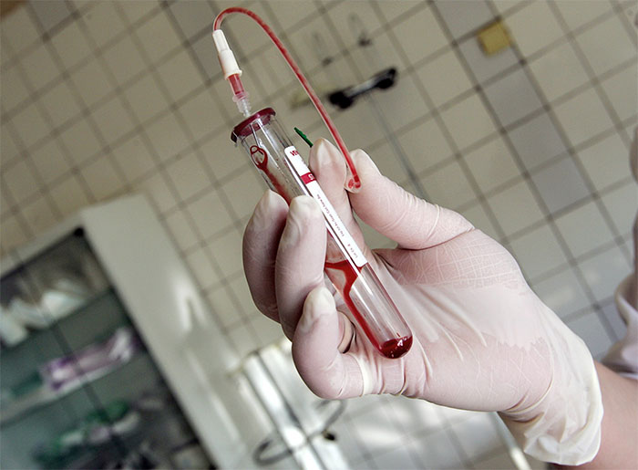 Picture 1 of Discover more new strains of HIV