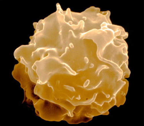 Picture 2 of Discover 'natural killer' in the body