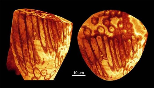 Picture 1 of Discover the largest, oldest sperm
