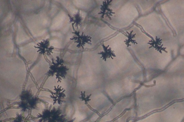 Picture 5 of Discover the nest of bacteria sleeping with your bed