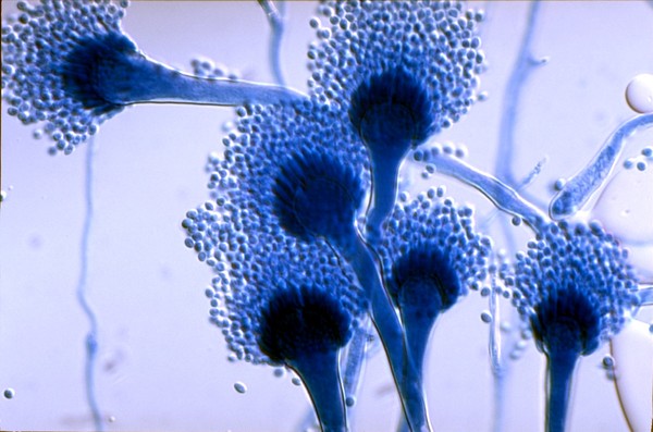 Picture 7 of Discover the nest of bacteria sleeping with your bed