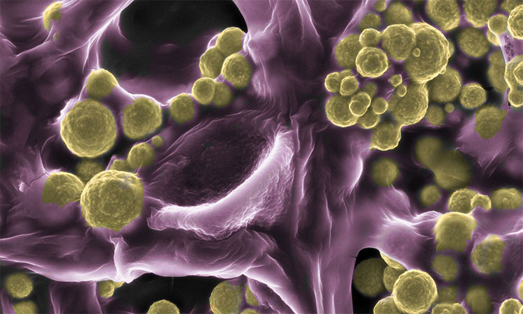 Picture 1 of Discover the whole fungus covered with gold