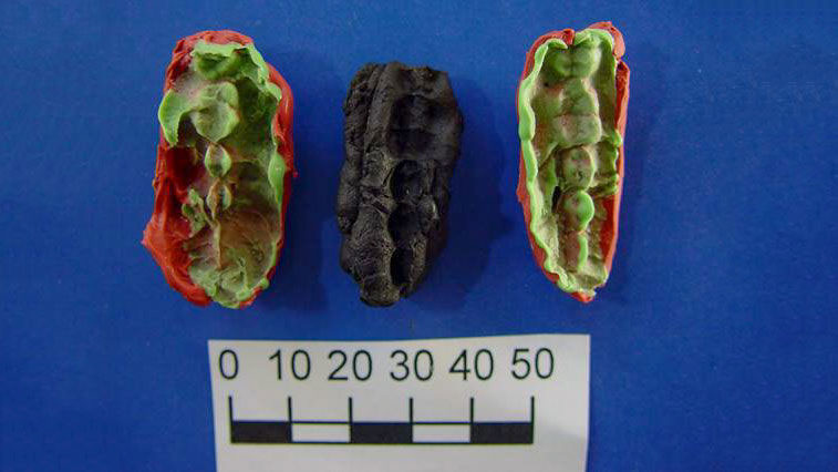 Picture 1 of Discovered 8,000-year-old ancient gum