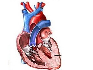 Picture 1 of Discovering a variety of gene variants that cause heart disease