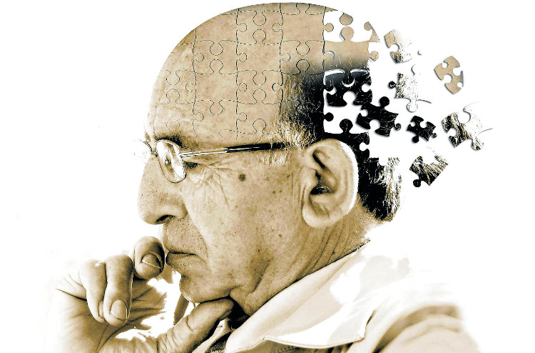 Picture 2 of Discovering anti-inflammatory drugs can treat Alzheimer's disease