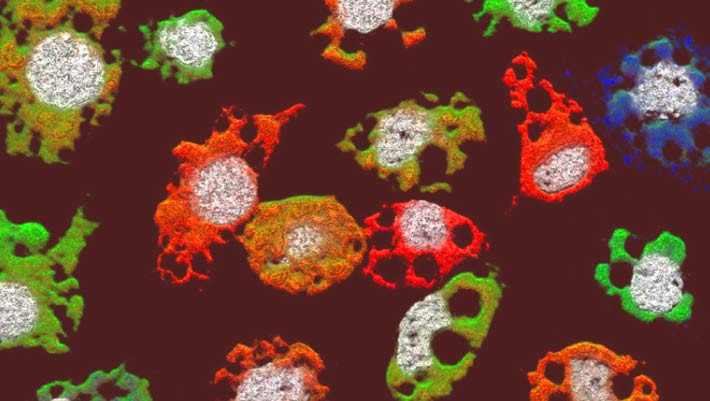 Picture 1 of Discovering new 'monsters' has the ability to invade a human body