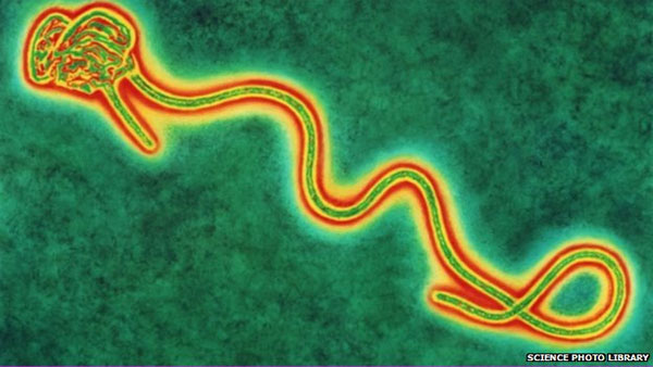 Picture 1 of Discuss the infection through the air of Ebola virus