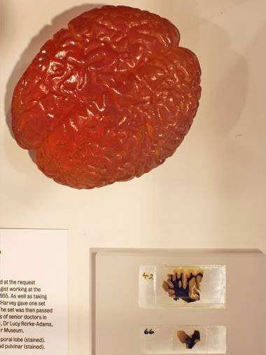 Picture 1 of Display a part of the brain of Einstein genius