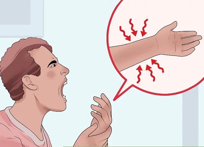 Picture 2 of Distinguish between wrist sprains and wrist fractures