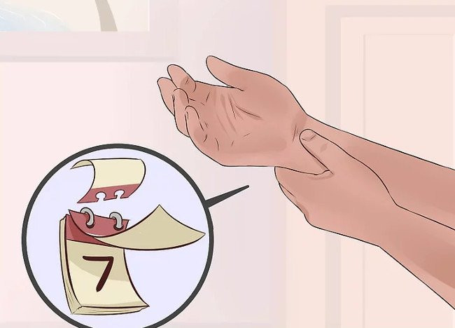 Picture 5 of Distinguish between wrist sprains and wrist fractures