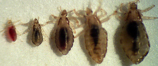 Picture 1 of DNA lice reveal human migration