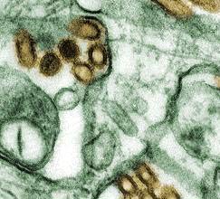 Picture 1 of Do not ignore strains of less toxic bird flu viruses