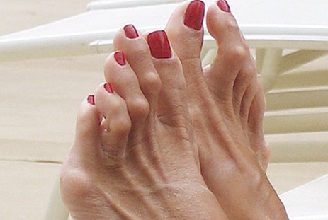 Picture 3 of Do not wear flip flops often