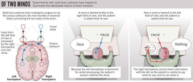 Picture 3 of Do people with brains split apart, are their souls divided into two different halves?