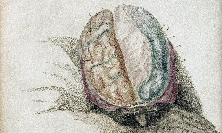 Picture 4 of Do people with brains split apart, are their souls divided into two different halves?