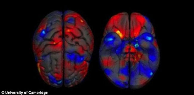 Picture 1 of Do you believe men's brains are really bigger than women?
