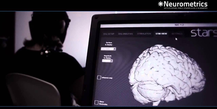 Picture 3 of Doctors can 'revive' the brain-dead patient, but only 1 week