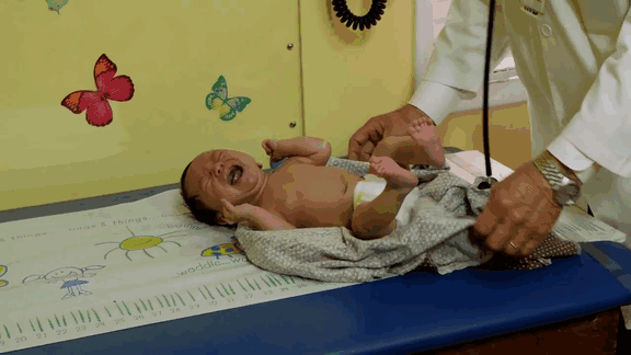 Picture 1 of Doctors from California, USA share clips to help children stop crying in a heartbeat