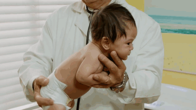 Picture 2 of Doctors from California, USA share clips to help children stop crying in a heartbeat
