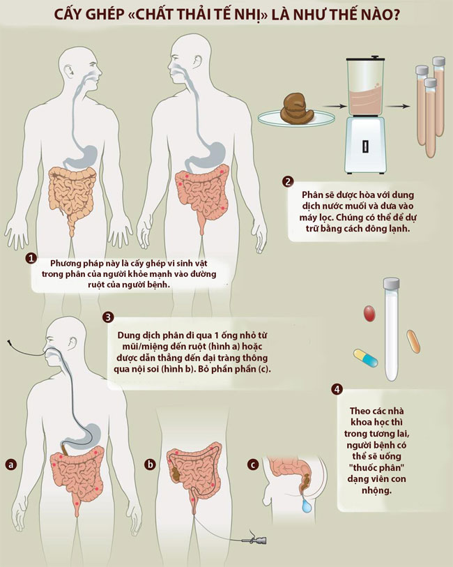 Picture 3 of Donation and transplantation of human waste in medicine - jokes but 100% true chemistry