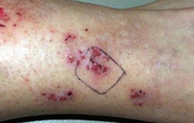 Picture 9 of Doubt about diseases originating from ... alien