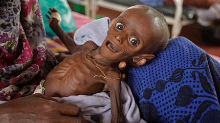 Picture 1 of Drought in Africa: 7-month-old babies weigh as much as babies