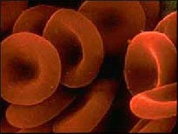 Picture 1 of Drugs that treat new hepatitis C, cheap