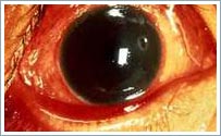 Picture 2 of Dry eye disease and unpredictable hazards