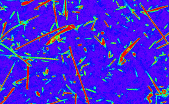 Picture 1 of Dyeing bacteria to study extraterrestrial life