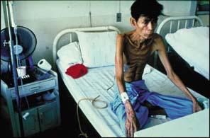 Picture 1 of Early detection and treatment of TB for HIV-infected people