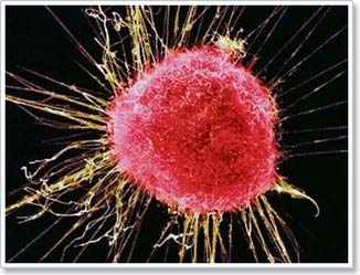 Picture 1 of Early detection of cancer cells